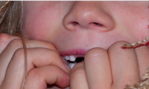 A child biting their fingernails, seen close up
